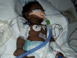 50 day Old kid with pneumonia needs money for treatment