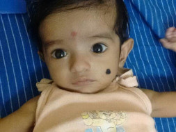 Need helping hands to save little baby boy