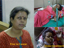 Help Mahua fight Cancer (CLL with p53 mutation)!