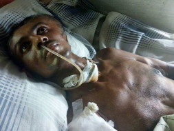 Help Manoj And His Family Live A Life With Dignity