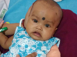 Help my 1-yr old niece undergo Bone Marrow Transplant to survive