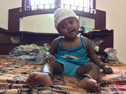 Baby Nidarshan Needs An Urgent Surgery To Replace His Skull