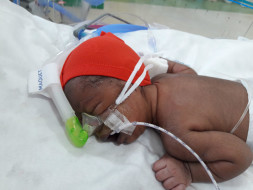 New Born Baby Needs Your Support To Live