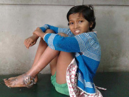 Help this 10-year-old girl so that she doesn't lose her leg !
