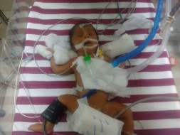 This Couple Needs Your Support To Save Their 3 Day-Old-Baby