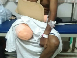 Help Kiran Raise Funds For An Artificial Limb
