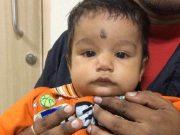 9-Month-Old Baby Needs An Urgent Heart Surgery