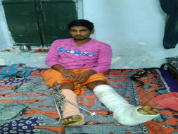 Help Aravindaraj - Bone Surgery