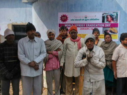 Help lepers in old Meerut Road, Hapur district of UP