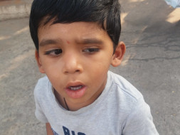 Help 4-year-old Yuvan who met with a tragic accident