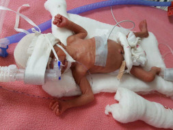Help a new born fight a battle of life.