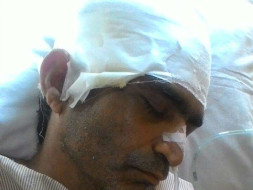 Support to Ram Ratan who met with a horrible accident