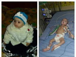 Help 1-Year-Old Inaya Naaz To Fight Pulmonology Edema