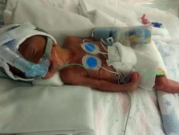 Help!! 25 weeks Premature Baby is in NICU, Family Need Help!!