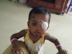 Give Baby Tanmayi the gift of Vision and Sight