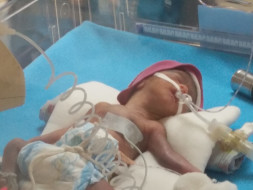 Help This Couple Save Their Extremely Premature Baby