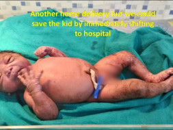 Save A Child from malnourishment