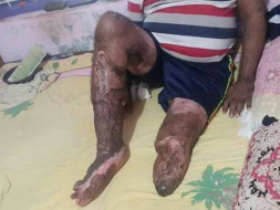 Help the Only Breadwinner of the Family Get Back On His Feet Again