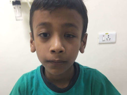 Help master Krishna get cochlear implant