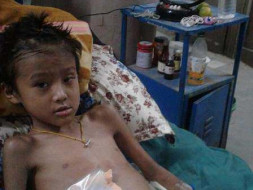 Help this 8 year old brave boy from losing his leg to gangrene
