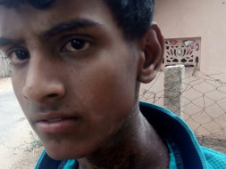 Help Ilavarasan Fight Nose Cancer
