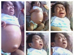 Seeking your suport for baby Prince's liver transplant
