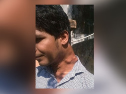 Save Rameez Khan From Paralysis