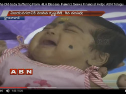 This 4-month-old baby needs our help to stay alive.