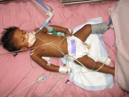 Help My 2-Year-Old Fight Acute Encephalopathy
