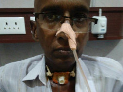 Help Narasa Reddy Afford Treatment for Throat Cancer