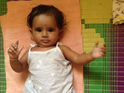 Fund Raising For Congenital Heart Surgery Of Child