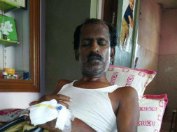 He Has No Stomach Because Of Cancer, Now It Is Attacking His Bones