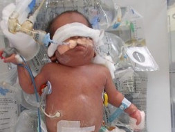 Help Asma's Premie Baby Get More Time To Fight And Survive
