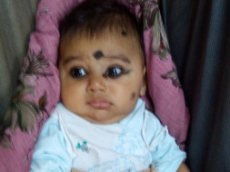This 4-month-old Baby Is Fighting Cancer Of Nerve Cells To Stay Alive