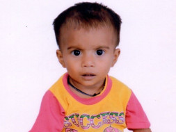 Help 2-year-old Vineet Undergo Open Heart Surgery