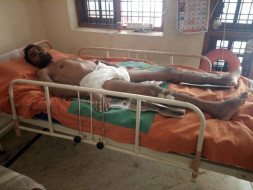 Help Bhanu fight full paralysis(neck-down) due to Spinal Cord fusion
