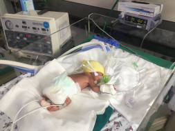 Bala's Twins Are Struggling To Live And He Has Noone For Support