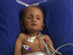 My 2 year 0ld son suffering from kidney cancer