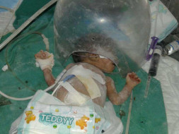 HELP PRITI'S TWIN BABIES
