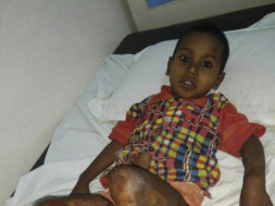 HELP BABY KARAN RECOVER FROM HIS PAIN!