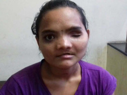 Help Vaishali Reclaim Her Life After A Horrific Accident