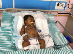 1 week Is All This Baby Has To Survive Acute Liver Failure