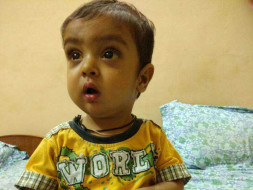 Help Shivansh Undergo a Liver Transplant