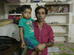 A Daily Wage Worker Seeks Help To Save His 3-year-old Daughter