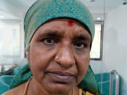 Saraswathi Is A Real Fighter: Help Her Beat Breast Cancer.