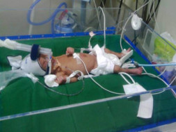 Baby Mehek-born at 32 weeks gestation pleads : "HELP ME FIGHT TO LIVE"
