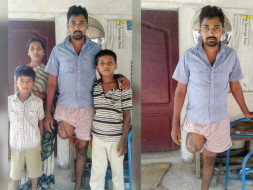 Help for Artificial limb and Livelihood