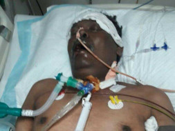 Help Madhukar fight septicemia and multi organ dysfunction