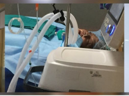 Help my mother to recover from ECMO and Dialysis