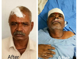 Help for Y Muthyallu double brain hemorrhage operation